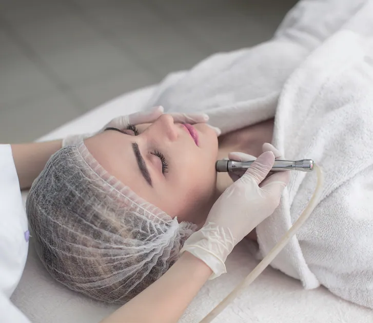 Diamant Microdermabrasion