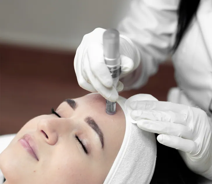 Microneedling